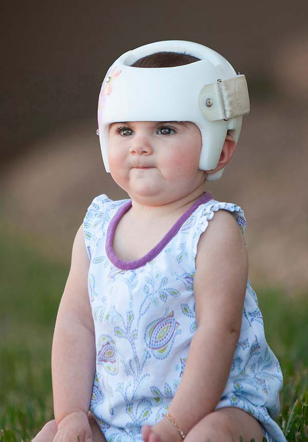 Cone head baby sales helmet